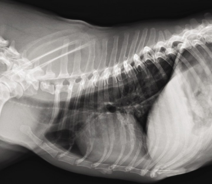 <p>Radiografía lateral derecha de tórax. Se detecta distensión generalizada de moderada a marcada del esófago intratorácico.</p>