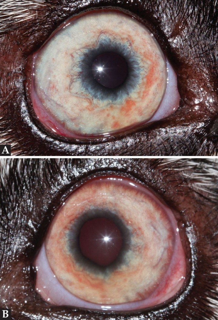 <p>Aspecto del (<strong>A</strong>) OD y (<strong>B</strong>) OS el primer día de consulta.</p>