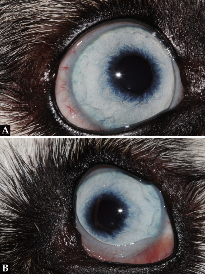 <p>Aspecto del (<strong>A</strong>) OD y (<strong>B</strong>) OS al mes de tratamiento.</p>