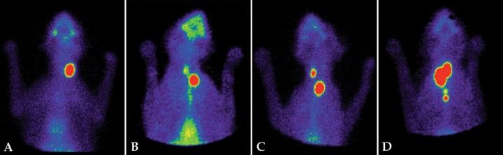 <p>Gammagrafías tiroideas con diferentes patrones de lesión en gatos. (<strong>A</strong>) Gato hipertiroideo, patrón unilateral. Aumento de captación de <sup>99m</sup>Tc (ratio T/S: 4,8) en el lóbulo tiroideo izquierdo. Lóbulo derecho suprimido y no visible. (<strong>B</strong>) Gato hipertiroideo, patrón bilateral. Aumento de captación (ratio T/S: 2,7) en el lóbulo tiroideo izquierdo. El lóbulo derecho es visible, y aunque su captación tenga una ratio T/S<1,5 (=1,06), se considera hiperfuncional. (<strong>C</strong>) Gato hipertiroideo, patrón bilateral asimétrico. Aumento de captación (ratio T/S: 6,35) en ambos lóbulos. El lóbulo tiroideo izquierdo, de mayor tamaño, aparece desplazado a la entrada de la cavidad torácica. (<strong>D</strong>) Gato hipertiroideo, patrón multifocal con tejido ectópico. Aumento de captación (ratio T/S: 14,4) en los dos lóbulos tiroideos y en tejido tiroideo ectópico mediastínico.</p>