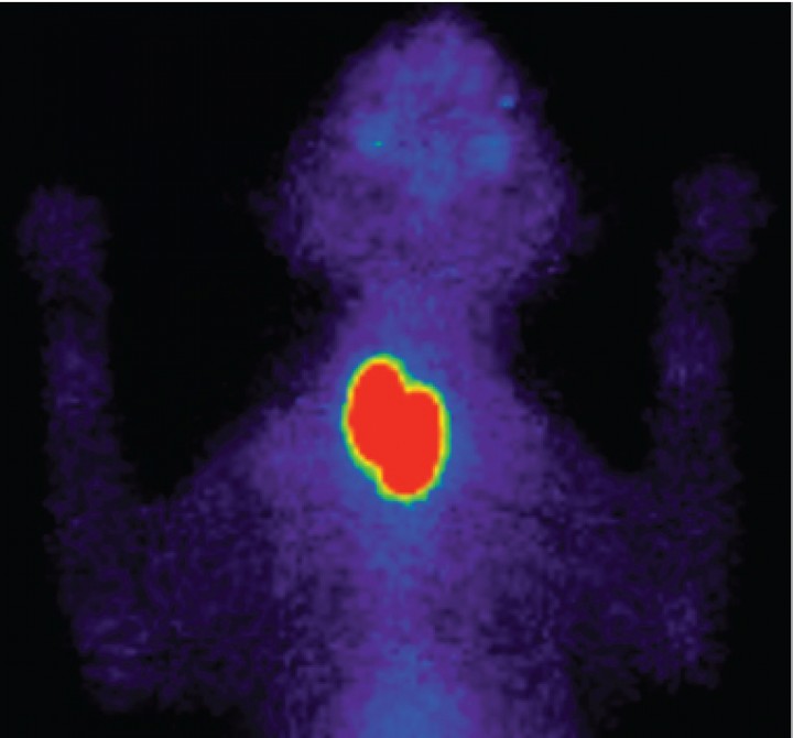 <p>Gammagrafía tiroidea de un gato con disminución de hormonas tiroideas (T<sub>4</sub> total y libre) y elevación de la TSH. Muestra un aumento de tamaño y captación de <sup>99m</sup>Tc-pertecnetato en ambos lóbulos tiroideos. Los datos clínicos y la imagen de la gammagrafía son compatibles con hipotiroidismo producido por dishormonogénesis.</p>