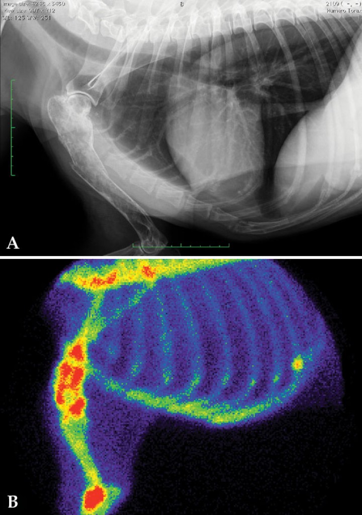 <p>Estudio por imagen de paciente canino con sospecha de tumor óseo primario en húmero derecho. (<strong>A</strong>) Radiografía con lesión osteolítica en tercio proximal del húmero derecho. (<strong>B</strong>) Gammagrafía ósea del mismo paciente. Se aprecia un aumento de captación de <sup>99m</sup>Tc-HDP en el tercio proximal del húmero compatible con neoplasia ósea primaria. Otros hallazgos son el aumento de captación del radiofármaco en la unión costocondral de la costilla n.º 11 (sugerente de artrosis), y en la zona distal de la escápula y articulación del codo (compatibles con enfermedad degenerativa articular).</p>