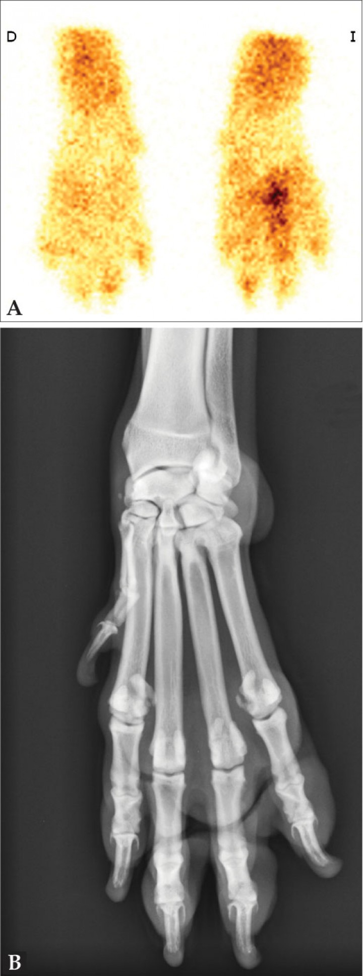 <p>Estudio por imagen de un perro con cojera oculta. (<strong>A</strong>) Gammagrafía en fase ósea en la que se observa un aumento de captación focal en el borde distal del IV metacarpiano de la mano izquierda. (<strong>B</strong>) Radiografía dorsopalmar de la articulación metacarpofalángica izquierda con signos de artrosis a la altura del cuarto metacarpiano y con sesamoideos metacarpofalángicos multipartidos. La gammagrafía permitió localizar el foco con patología en la porción distal de la extremidad, centrando el estudio radiológico en ella y sugiriendo la presencia de artrosis y tendinitis del flexor digital profundo.</p>