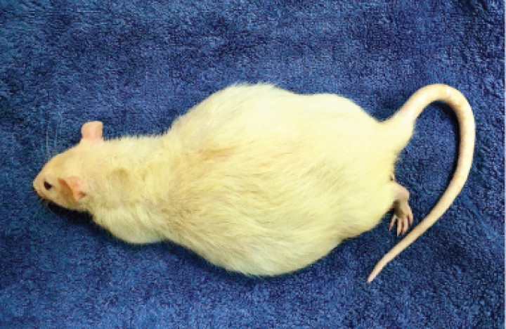 <p>La paciente con distensión abdominal por acumulación de líquido ascítico.</p>