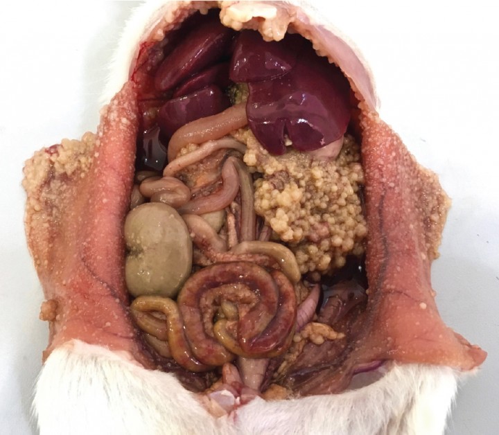 <p>Imagen macroscópica de la cavidad abdominal con el peritoneo y la superficie de los órganos y el omento recubiertos por tumoraciones.</p>