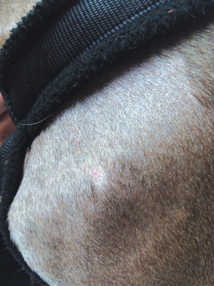 <p>Imagen de evolución del nódulo subcutáneo de la región escapular izquierda donde se puede apreciar su desaparición.</p>