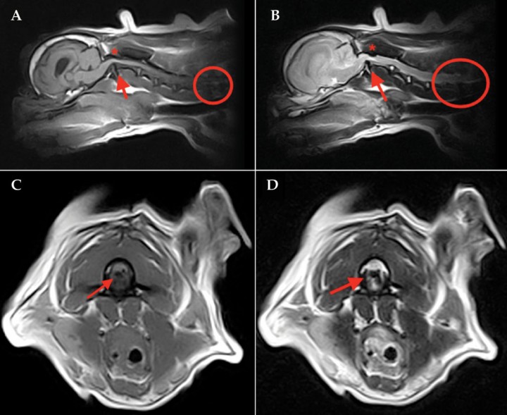 <p>Imágenes de RM preoperatoria del paciente. (<strong>A</strong>) Corte en plano medio sagital en T1. (<strong>B</strong>) Corte en plano medio sagital en T2. (<strong>C</strong>) Corte en plano transversal en T1. (<strong>D</strong>) Corte en plano transversal en T2. Se aprecia el desplazamiento dorsal del axis produciendo compresión medular (flechas rojas). Se observa una compresión dorsal de la médula espinal entre C1 y C2 compatible con una banda dural, una hipertrofia de la membrana atlantoaxial o del ligamento atlantoaxial dorsal (asterisco). A nivel de C1-C2 se observa una lesión intramedular, de bordes mal definidos, hipertensa (respecto a la sustancia gris) en T2 y de isointensa a hiperintensa en T1. También se visualiza espondilosis y discopatía degenerativa que afecta a los discos C5-C6 y C6-C7 (círculo rojo) que se asocia con una leve mielopatía compresiva a nivel de C6-C7. A nivel intracraneal se visualiza una dilatación de los ventrículos laterales, probablemente asociado a la raza.</p>