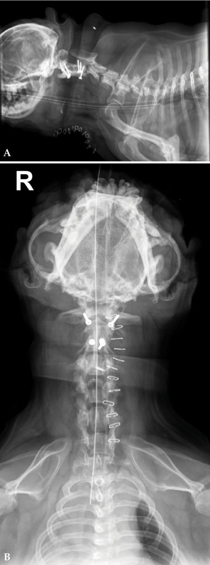 <p>Radiografía post-quirúrgica. (<strong>A</strong>) Lateral derecha. (<strong>B</strong>) Ventrodorsal. Se visualiza la estabilización atlantoaxial mediante tornillos y polimetilmetacrilato con gentamicina. R: derecha.</p>