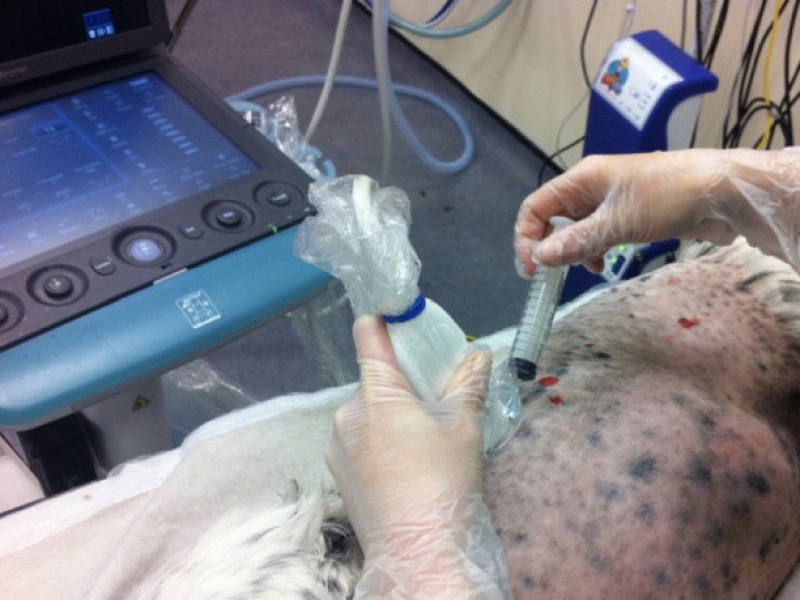 <p>Imagen que muestra la posición del transductor y la aguja para el bloqueo intercostal.</p>