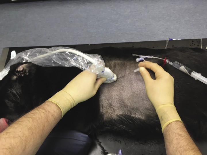 <p>Imagen que muestra la posición del transductor y la aguja para el bloqueo del serrato.</p>