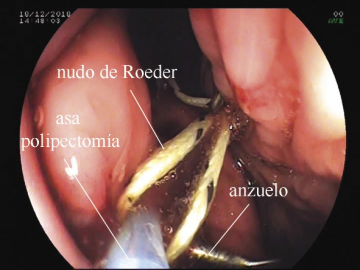 <p>Paso del lazo con el nudo de Roeder por la paleta del anzuelo para anudarlo en la tija (ver Vídeo 2).</p>