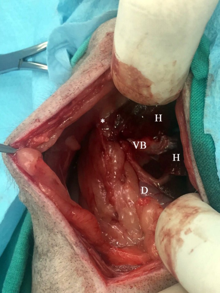 <p>Imagen durante la cirugía del Caso 2, en la que al localizar la zona de la vesícula biliar (VB), no es posible distinguirla debido a las adherencias que presenta a la pared abdominal craneal (asterisco), duodeno (D) y parénquima hepático (H).</p>