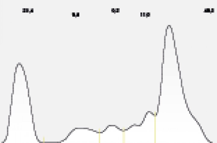 <p>Proteinograma de la gata de la Tabla 3 que permite confirmar la sospecha de mieloma múltiple por la presencia de gammapatía monoclonal.</p>