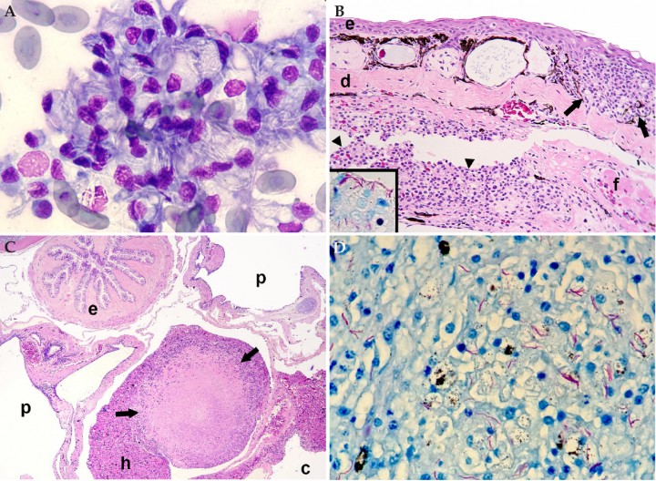 <p>(<strong>A</strong>) Bazo; rana toro (<em>Lithobates catesbeianus</em>). Se aprecian macrófagos con numerosos bacilos fantasma en su citoplasma. Diff-Quick, x1000. (<strong>B</strong>) Piel, seno linfático subcutáneo; rana flecha azul (<em>Dendrobates azureus</em>). La dermis (d) contiene un granuloma (flechas). El seno linfático subcutáneo está dilatado y parcialmente obstruido por un trombo de fibrina (f) e inflamación granulomatosa (cabezas de flecha) (endolinfangitis granulomatosa y trombótica); e: epidermis. Hematoxilina-eosina, x200. Recuadro: bacilos ácido-alcohol intralesionales en granuloma endolinfático. Tinción de Ziehl-Neelsen, x400. (<strong>C</strong>) Cavidad celómica; sapito balear (<em>Alytes muletensis</em>). Se observa un granuloma con gran centro necrótico (flechas) en el hígado (h); c: cavidad celómica, p: pulmón, e: esófago. Hematoxilina-eosina, x48. (<strong>D</strong>) Bazo; rana toro (<em>Lithobates catesbeianus</em>). Se aprecian numerosos bacilos ácido-alcohol resistentes alargados en una zona de esplenitis granulomatosa. Ziehl-Neelsen, x480.</p>
