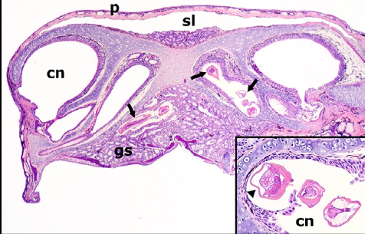 <p>Cabeza; sapito minero (<em>Dendrobates leucomelas</em>). Sección transversal de la cabeza a nivel de la cavidad nasal que demuestra la presencia de nematodos (flechas) en la cavidad nasal (cn) y glándulas salivares (gs); p: piel, sl: seno linfático subcutáneo. Hematoxilina-eosina, x48. Recuadro: nematodos nasales a mayor aumento, en uno de los cuales (derecha) se aprecian proyecciones alares laterales; estos parásitos causan atrofia por compresión de la mucosa nasal (cabeza de flecha). Hematoxilina-eosina, x480.</p>
