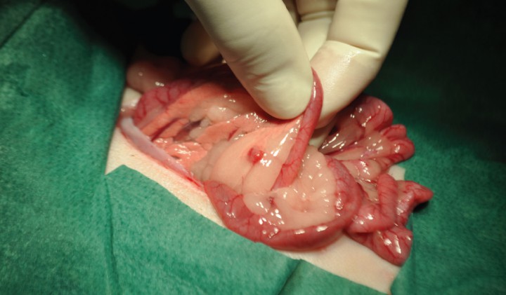 <p>Imagen quirúrgica de un nódulo en páncreas compatible con insulinoma.</p>