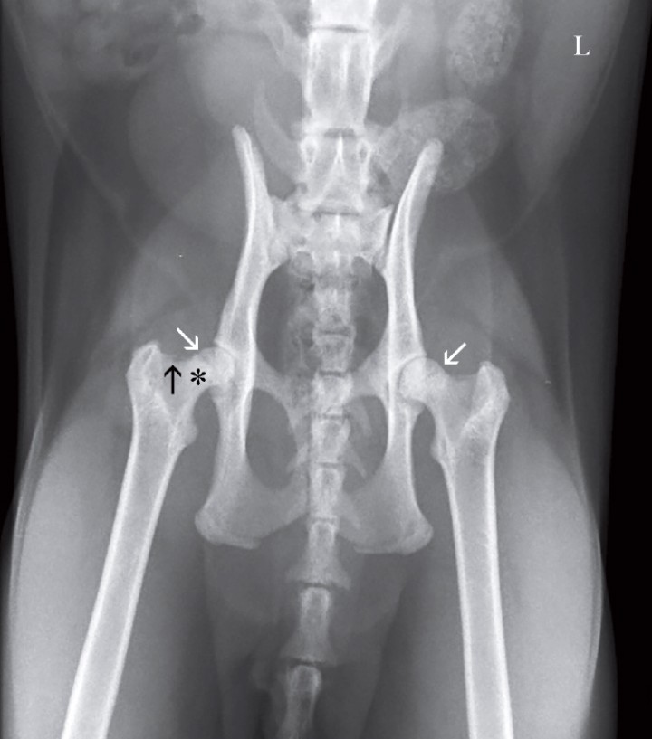 <p>Misma imagen que la Figura 1. Se aprecia en ambas extremidades una línea radiotransparente en la cabeza femoral, correspondientes al cartílago de crecimiento de la cabeza femoral (flechas blancas). En el cuello femoral derecho se visualizan osteofitos (flecha negra) y pequeñas áreas osteolíticas (asterisco). Los cartílagos de crecimiento de las tuberosidades isquiáticas y la sínfisis pélvica permanecen sin fusionar. L: izquierda.</p>