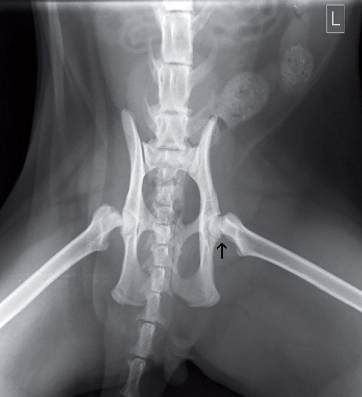 <p>Proyección ventrodorsal con las extremidades en abducción. Se observa un desplazamiento entre la epífisis proximal femoral derecha y la metáfisis, así como la mala congruencia entre el cuello femoral y la epífisis proximal izquierda (flecha). L: izquierda.</p>