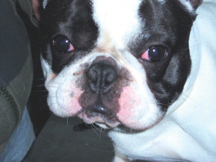 <p>Estenosis nasal.</p>