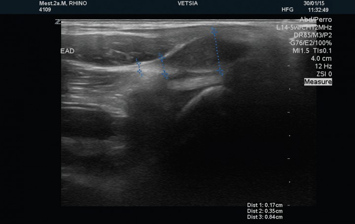 <p>Corte sagital del tendón del músculo supraespinoso derecho sin alteraciones.</p>