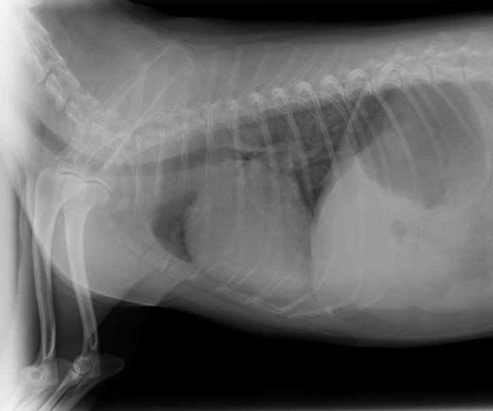 <p>Presencia de patrón alveolar en región perihiliar, compatible con edema pulmonar cardiogénico.</p>