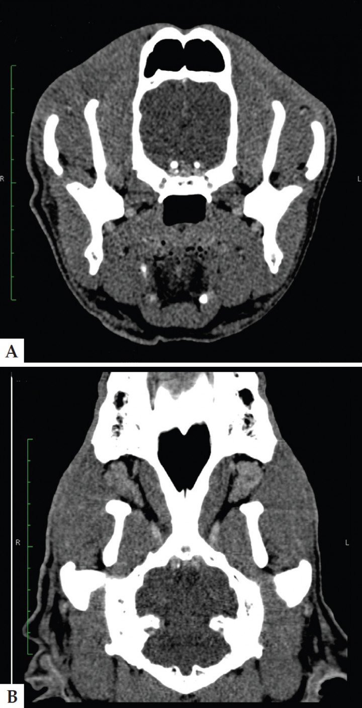 <p>Imagen de tomografía computarizada con ventana de tejido blando en la revisión realizada un mes después de iniciar el tratamiento (A. Axial; B. Dorsal) en la que se puede observar la recuperación completa del absceso y sialoadenitis. Ancho de ventana 236 UH. Centro de ventana 100 UH.</p>