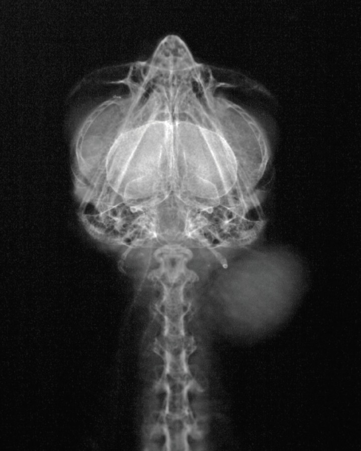 <p>Radiografía DV de la cabeza y cuello. Se aprecia una masa de opacidad tejido blando en la zona izquierda.</p>