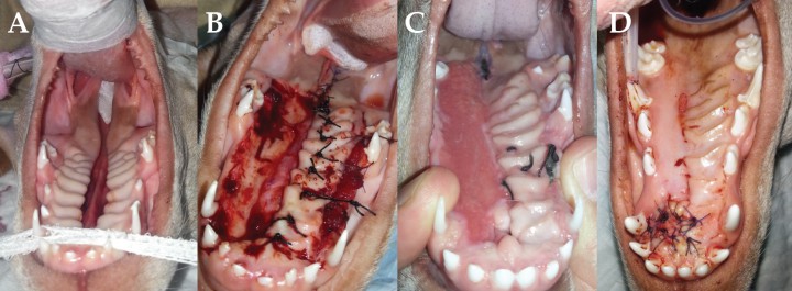 <p>A. Fisura palatina secundaria congénita completa. B. Intervención mediante Técnica de Howard. C. Aparición de dehiscencia rostral. D. Autoinjerto de cartílago auricular.</p>