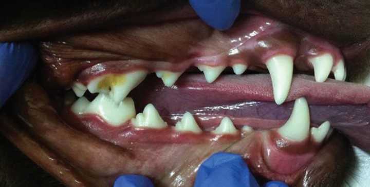 <p>Oclusión normal. Se puede apreciar la oclusión fisiológica de cada pieza.</p>