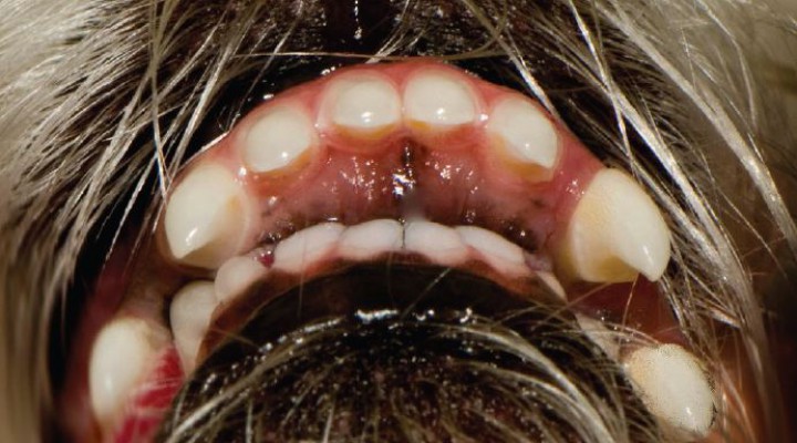 <p>Maloclusión de Clase 2. Existe un crecimiento mayor del maxilar que de la mandíbula. Copyright© AVDC®, used with permission.</p>