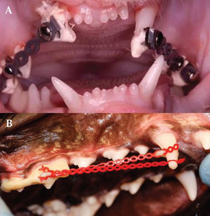 <p>A. Ortodoncia. Técnica de cadeneta y botones para resolver mesioversión de caninos maxilares en un gato. B. Variación de la técnica de cadenetas y botones utilizada en la Figura 7A para desplazamiento distal del canino maxilar derecho y corrección de la oclusión traumática contra el canino mandibular. En este caso, entre los botones del cuarto premolar y primer molar se ha añadido un gancho de cerclaje. El gancho en el canino y en la unidad funcional del cuarto premolar y primer molar sirven como anclaje para las cadenas. (Imagen cedida por A. Castejón González. Copyright Dentistry and Oral Surgery Service. Penn Vet. University of Pennsylvania).</p>