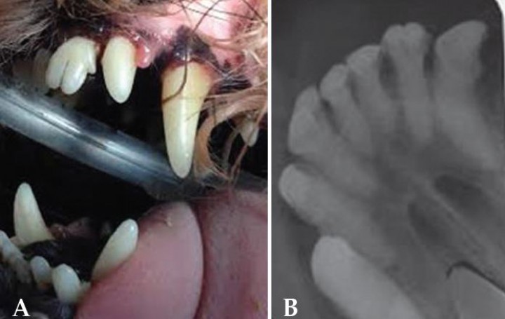 <p>A. Diente bigeminado. B. Apréciese la doble corona y única raíz del incisivo central izquierdo (202).</p>
