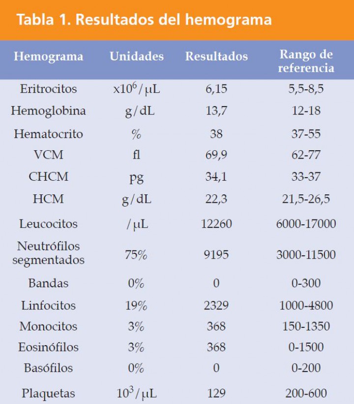 <div class=\"Basic-Text-Frame\">
<p>VCM: volumen corpuscular medio; CHCM: concentración de hemoglobina corpuscular media; HCM: hemoglobina corpuscular media.</p>
</div>