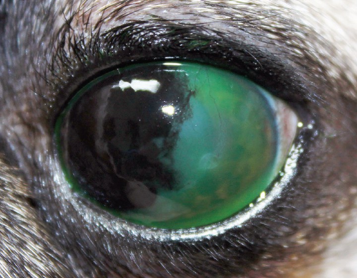 <p>Ojo izquierdo tras instilación de fluoresceína para realizar el tiempo de ruptura de la película lagrimal, observamos una pigmentación corneal muy densa que ocupa el 50% de la córnea y neovascularización.</p>