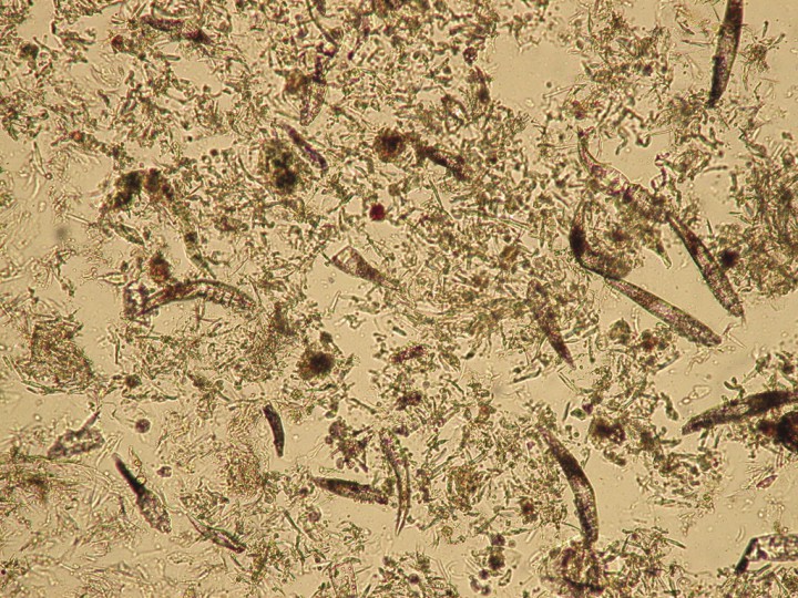 <p>Raspado profundo de zona facial con gran cantidad de <em>Demodex canis</em>.10x.</p>