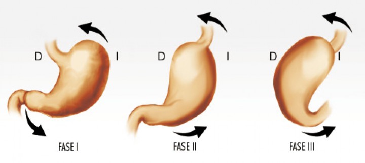 <div class=\"Basic-Text-Frame\">
<p>Esquema de la rotación del estómago sobre su eje longitudinal, visualizándose como el píloro se desplaza hacia caudal y dorsal, manteniéndose en el lado izquierdo (Fase I y II) y el fundus gástrico se dirige craneal y ventralmente, situándose en el lado derecho del paciente (Fase III).</p>
</div>