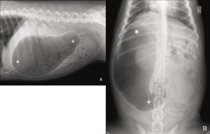 <p>Radiografía lateral derecha (A) y dorso-ventral (B) de la cavidad abdominal tras la descompresión, en un perro con DVG por rotación sobre el eje longitudinal, donde puede visualizarse la lateralización del fundus (*) hacia la derecha y el desplazamiento caudal del antro pilórico (+). (Copyright de AVEPA, utilizado con autorización).</p>
