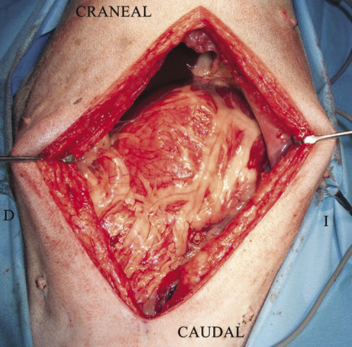 <p>Imagen intraoperatoria al realizar la laparotomía por línea media en un animal con DVG, visualizándose el omento cubriendo el estómago, signo indicativo de la presencia de torsión gástrica (Imágen cedida por Manuel Jiménez Peláez).</p>