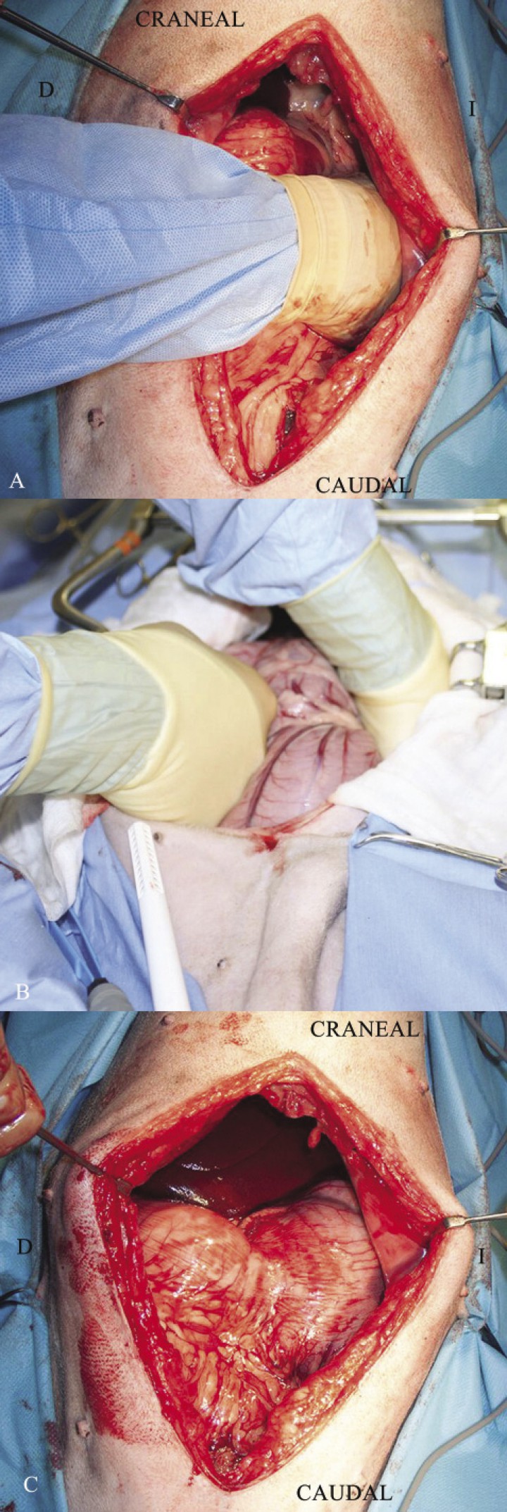 <p>Secuencia de la maniobra intraoperatoria de la desrotación y recolocación del estómago en un perro con DVG: (A) Localización con la mano derecha del antro pilórico que se localiza de forma anormal en el lado izquierdo y dorsal del paciente. (B) De manera cuidadosa, con la mano izquierda se hará presión sobre el fundus del paciente al tiempo que con la mano derecha se traccionará del antro pilórico para colocarlo en su posición anatómica en el lado derecho del animal. (C) Imagen final tras la desrotación del estómago (Imágenes cedidas por Manuel Jiménez Peláez).</p>