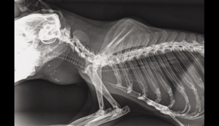 <p>Radiografía lateral del tórax. Se observa calcificación del nódulo y mineralización de la aorta.</p>