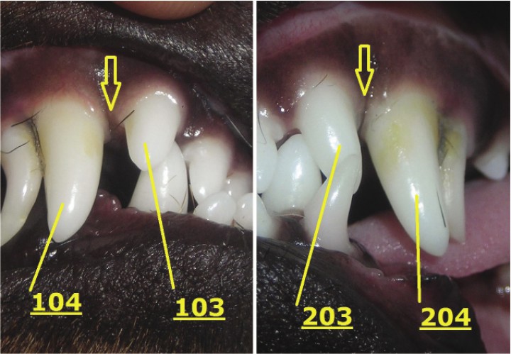 <p>Imágenes aumentadas de la Figura 1. Se aprecian los caninos superiores e incisivos superiores laterales y su denominación. Ausencias de diastema entre 103-104 y 203-204, señaladas con flechas.</p>