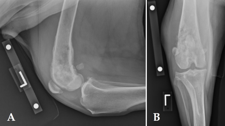 <p>Radiografíaslateral (A) y cráneo-caudal (B) de miembro pélvico izquierdo de un San Bernardo de 9 años de edad que se presentó con historia de cojera detectada 2 semanas antes. Obsérvese la zona de lisis apolillada con márgenes irregulares y una zona extensa de transición en la metáfisis distal del fémur.</p>
