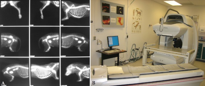 <p>(A) Imágenes obtenidas mediante escintigrafía en las que se observan áreas de acumulación de tecnecio-99m. (B) Sala de gammagrafía.</p>