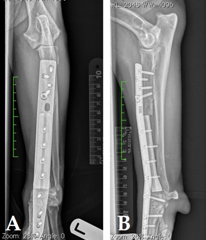 <p>Radiografías cráneo-caudal (A) y lateral (B) tras la realización de cirugía con preservación del miembro mediante la técnica de endoprótesis.</p>