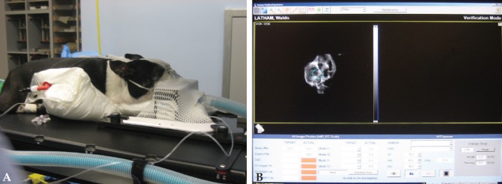 <p>Cirugía estereotáctica. (A) Colocación del paciente con anclaje oral para realización de TAC. (B) Imagen computerizada de la zona a irradiar.</p>