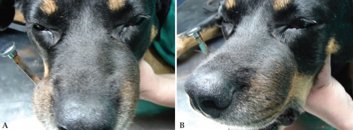 <p>Imágenes de la primera visita. (A) Frontal (B) Lateral. Se aprecia asimetría facial debida a la presencia de tumefacción maxilar izquierda.</p>