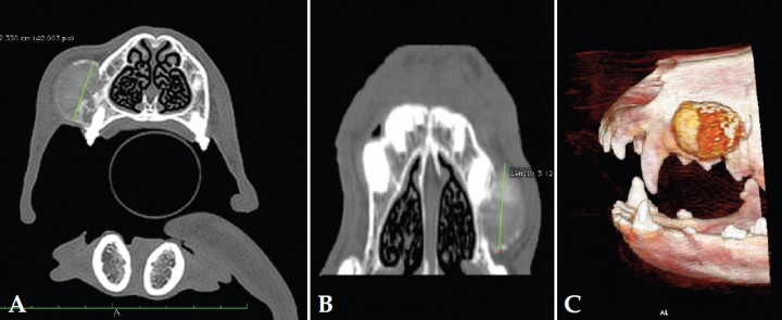 <p>Imágenes de TAC precontraste en ventana de huesos. (A) Plano transversal. (B) Plano dorsal (C) 3D. Se aprecia lesión nodular en la región lateral derecha del hueso maxilar (imágenes cedidas por Diagnosfera).</p>