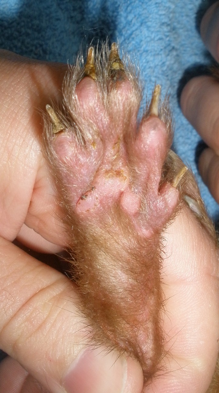 <p>Hiperqueratosis plantar.</p>