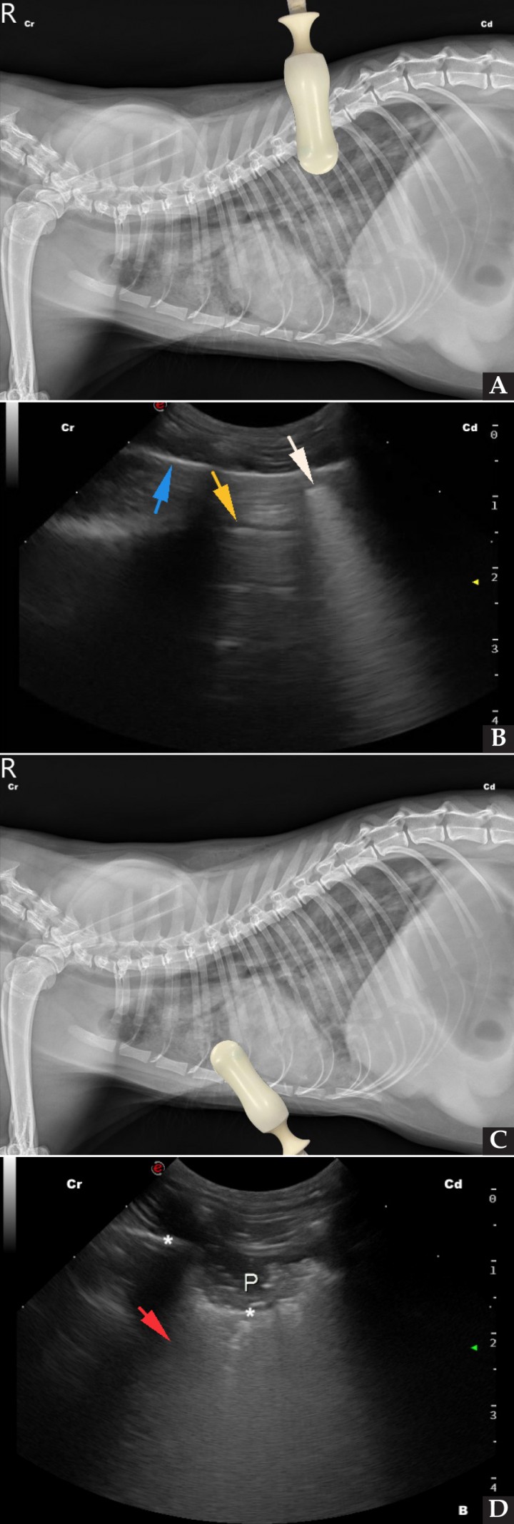 <div class=\"Basic-Text-Frame\">
<p>(<strong>A</strong>) Radiografía lateral derecha de un gato con edema pulmonar no cardiogénico, con la colocación de la sonda ecográfica en el punto de valoración del cuadrante DC. (<strong>B</strong>) Imagen ecográfica del cuadrante DC del mismo paciente, donde se aprecian líneas B o pulmón húmedo (flecha blanca), líneas A o pulmón sano (flecha amarilla) y línea PP (flecha azul). (<strong>C</strong>) Radiografía lateral derecha del mismo paciente con la colocación de la sonda ecográfica en el punto de valoración del cuadrante PH. (<strong>D</strong>) Imagen ecográfica del cuadrante PH, donde se puede observar la presencia de una línea B ancha (flecha roja), así como parte del parénquima pulmonar consolidado (P), generando como consecuencia el signo de escalón (asteriscos). Cr: craneal; Cd: caudal.</p>
</div>

<div>
<div class=\"frame-2\"> </div>
</div>