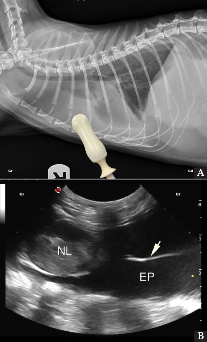 <p>(<strong>A</strong>) Radiografía de un gato con linfoma multicéntrico y efusión pleural severa, con la colocación de la sonda ecográfica en el punto de valoración del cuadrante PH. (<strong>B</strong>) Imagen ecográfica del mismo gato valorando el cuadrante PH, donde se puede observar un nódulo linfático esternal moderadamente aumentado de tamaño (NL), así como abundante contenido anecoico entre ambas pleuras, confirmando la presencia de efusión pleural (EP) y la presencia de fibrina fluctuando en el líquido pleural (flecha blanca). Cr: craneal; Cd: caudal.</p>